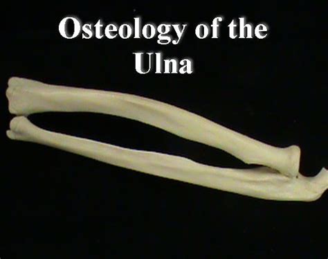 Osteology: The Ulna - Anatomy Guy