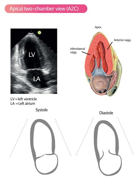 Standard Transthoracic Echocardiogram: Complete Imaging Protocol – ECG ...