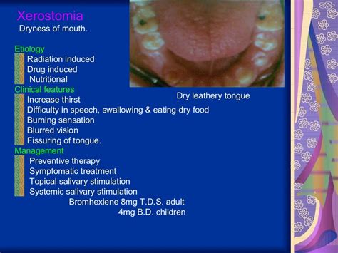 Disorders of salivary glands