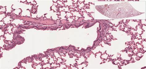 Respiratory System and Quiz 4 | histology