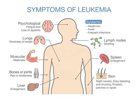 Treatment Options for Leukemia | Onco.com