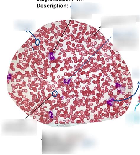 Blood smear Diagram | Quizlet