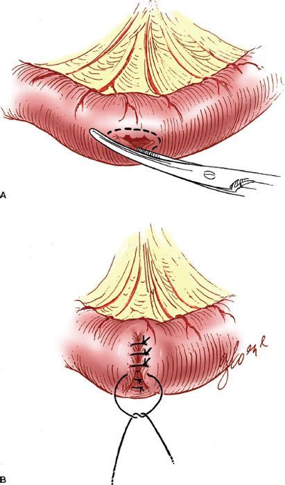 Surgical Techniques | Oncohema Key