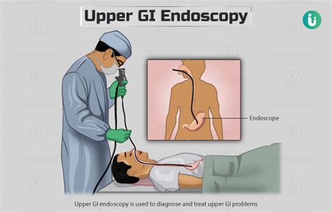 Upper GI Endoscopy: Procedure, Purpose, Results, Cost, Price, Online booking