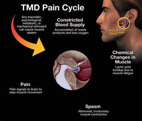 Manual Therapy Techniques For Tmj at Francisco Ryerson blog