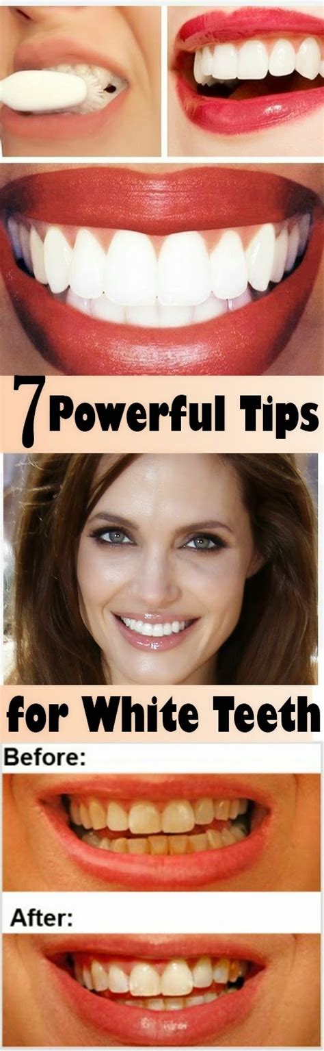 7 Powerful Tips For White Teeth | Natural Solutions