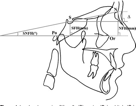 [PDF] Constancy of the angle between the Frankfort horizontal plane and ...