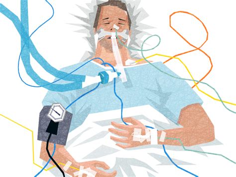 Post-Intubation Sedation in the ED: The Basics EMRA