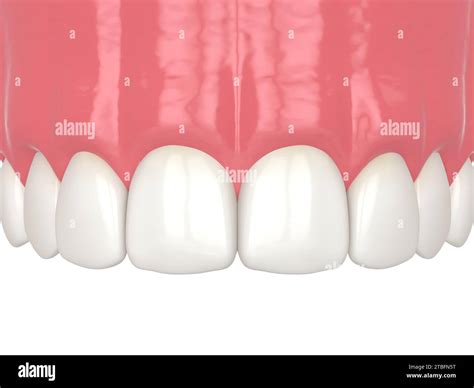 3d render of diastema closure using bonding procedure. Part 9 - Final result of tooth restoring ...