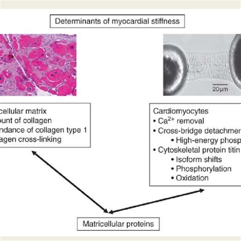 Extracellular matrix and cardiomyocytes determine myocardial stiffness... | Download Scientific ...