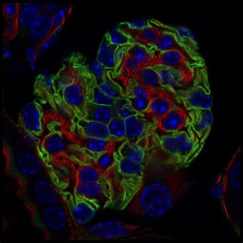 confocal | Universitätsklinikum Freiburg