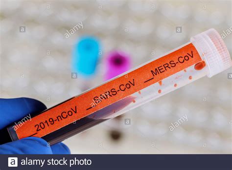 Mers cov hi-res stock photography and images - Alamy