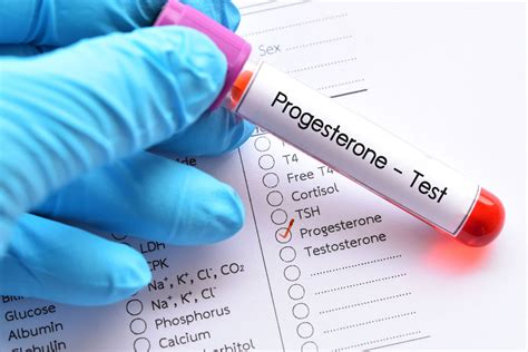 Progesterone Test | Testing Your Progesterone Levels – HrtORG