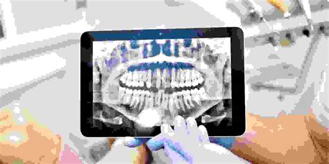 Digital X-Rays | MP Dental