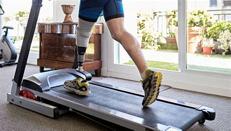 Amputation: Recovery and Rehabilitation | Johns Hopkins Medicine