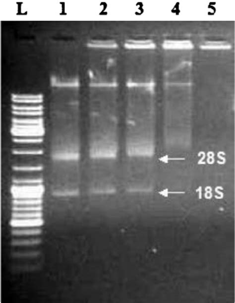 Gel Electrophoresis Ladder