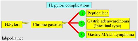 Urea Breath Test for Pylori (Helicobacter Pylori) - Labpedia.net