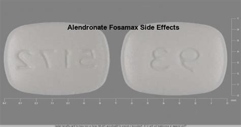 Alendronate fosamax side effects, is fosamax safe to use | - luckyfeathers.com