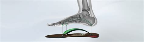 Custom Shoe Orthotics Greenville, SC - Zone Physical Therapy