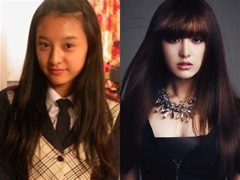 Kim Ji Won Plastic Surgery Nose Job Before And After Pictures Kim Ji ...