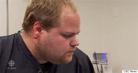 GRAPHIC IMAGES: Guy Gets Stretched Earlobes Sewn Up In Gruesome Surgery