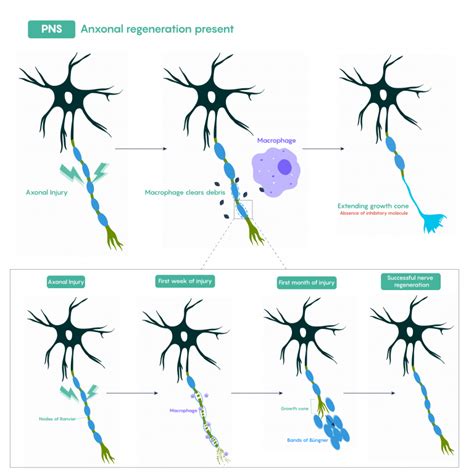 2.1: Acute Physical Damage to the Nervous System - Medicine LibreTexts