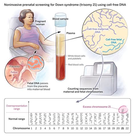 Noninvasive prenatal testing using fetal DNA - Lasker Foundation