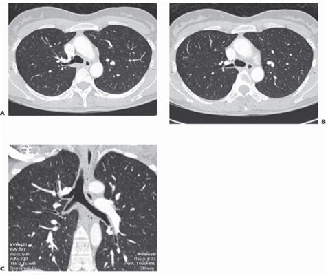 Introduction to Imaging Methodology and Airway Anatomy | Radiology Key