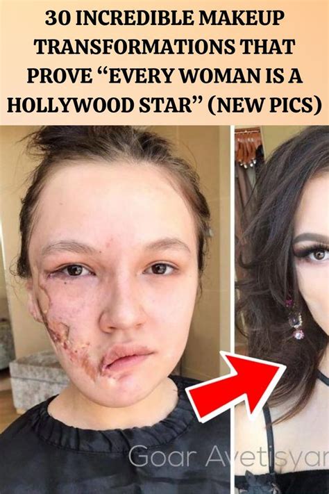 Bad Celebrity Plastic Surgery, Bad Plastic Surgeries, Makeup Masters, Celebrity Facts, Celebrity ...