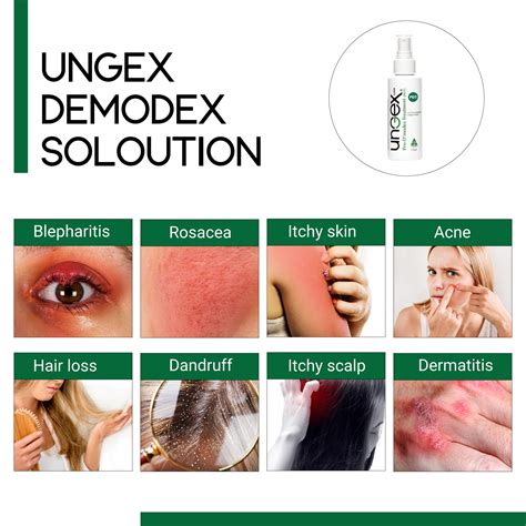 Ungex Pro-Demodex Treatment For Demodicosis PDT | mail.napmexico.com.mx