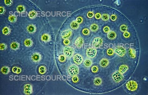 Eudorina Under Microscope