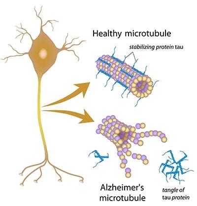 Secrets of the Haunted Brain: Ghost Tangles | Bio-Rad