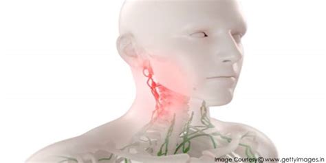 Symptoms of Lymph Node Cancer | Cancer