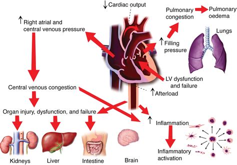 The Pathophysiology Of Hypertensive Acute Heart Failure Heart