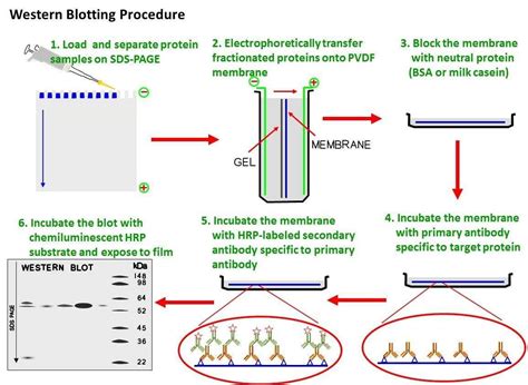 Western Blotting - Principle , Method & Diagram