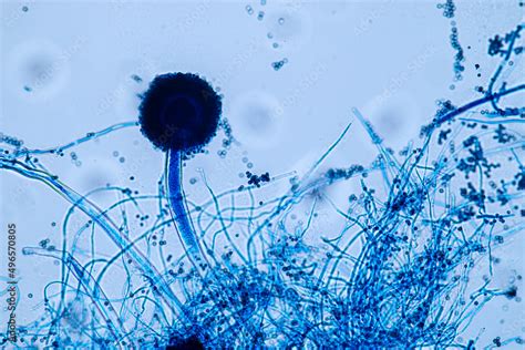 Aspergillus niger and Aspergillus oryzae (mold) under microscope for ...