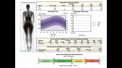 Bone Density Scanning and Results Score Analysis - YouTube