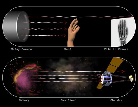 Chandra :: Resources :: X-Ray Astronomy vs. Medical X-Rays