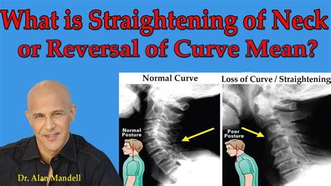 how to correct your neck curve - hardmanfaruolo