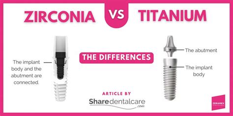 Zirconia vs Titanium Implants: The Differences - Zeramex USA