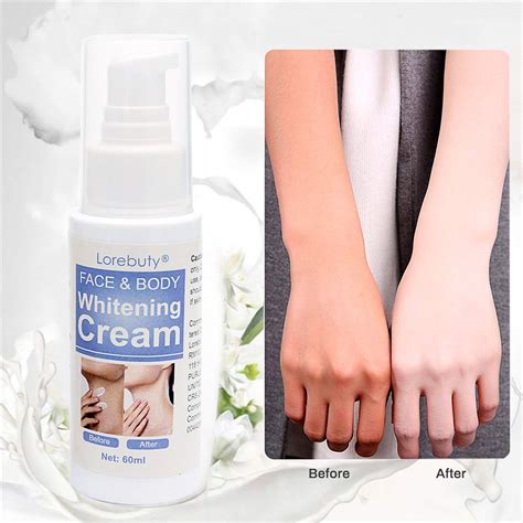 Whitening Cream For Hard Skin at Royal Edwards blog