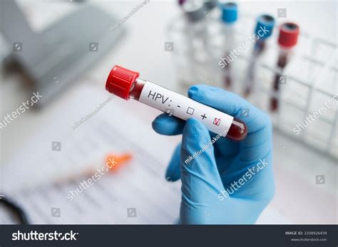 Hpv Test Report Photos and Images | Shutterstock