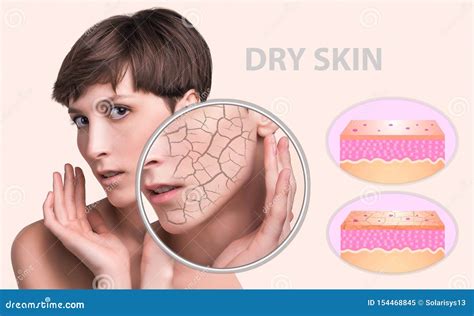 Concept of Cosmetic Effects, Treatment and Skin Care. Stock Image ...