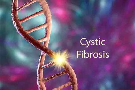 Cystic Fibrosis- Causes, Symptoms, Treatments, & More