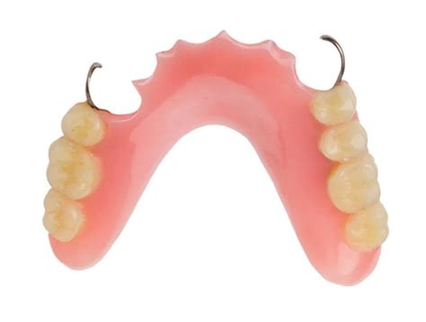 Partial Acrylic Dentures - Twinkle Family Dentalcare