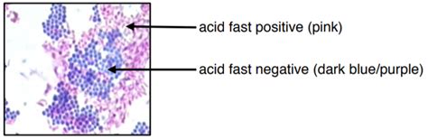 💄 Acid fast stain lab report. Acid. 2022-10-13