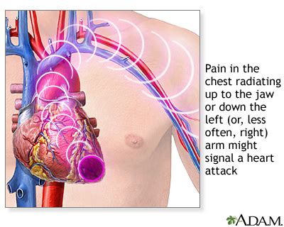 Stabbing Pain Between Shoulder Blades: mid back or thoracic spine pain with referral around into ...