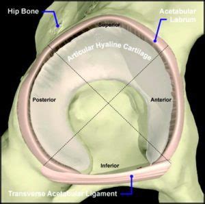 Hip Labral Tear Recovery Without Surgery (2022)