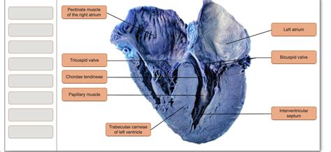 SOLVED: Label the dissected heart: - Pectinate muscle of the right atrium - Left atrium ...