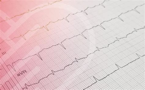 Irregular Heartbeat | Causes & Treatment | Vital Heart & Vein Blog